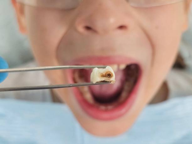 Best Weekend Emergency Dentist in Arthur, IL